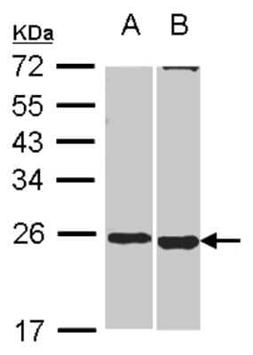 Western Blot: SOHLH2 Antibody [NBP2-20453]