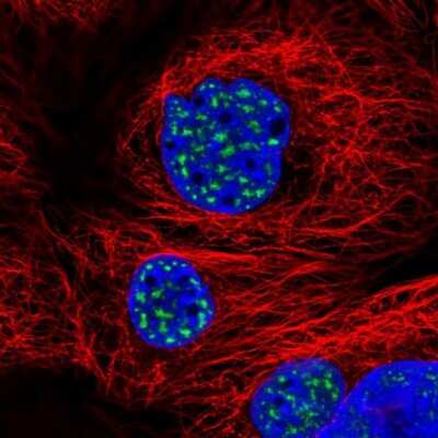 Immunocytochemistry/ Immunofluorescence: SON Antibody [NBP2-55411]