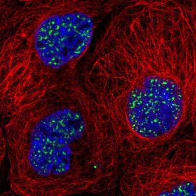 Immunocytochemistry/ Immunofluorescence: SON Antibody [NBP2-55412]