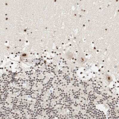 Immunohistochemistry-Paraffin: SON Antibody [NBP1-88706]