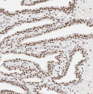 Immunohistochemistry-Paraffin: SON Antibody [NBP1-88706]