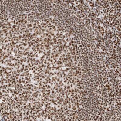 Immunohistochemistry-Paraffin: SON Antibody [NBP1-88706]