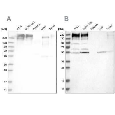 Western Blot: SON Antibody [NBP2-55411]