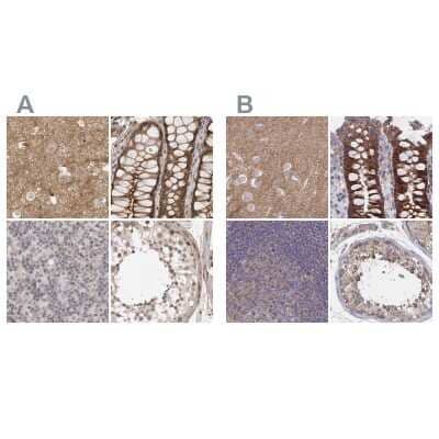 Immunohistochemistry-Paraffin: SORBS1 Antibody [NBP1-86641]