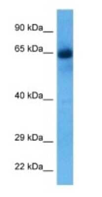 Western Blot: SORBS1 Antibody [NBP3-09446]