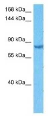 Western Blot: SORBS1 Antibody [NBP3-09956]