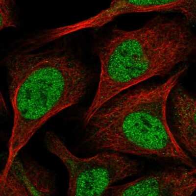 Immunocytochemistry/ Immunofluorescence: SORBS2 Antibody [NBP1-88836]