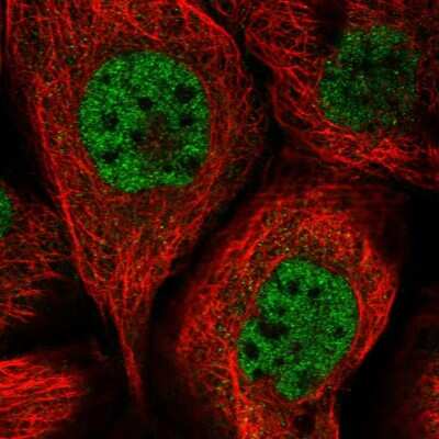 Immunocytochemistry/ Immunofluorescence: SORBS2 Antibody [NBP2-32672]