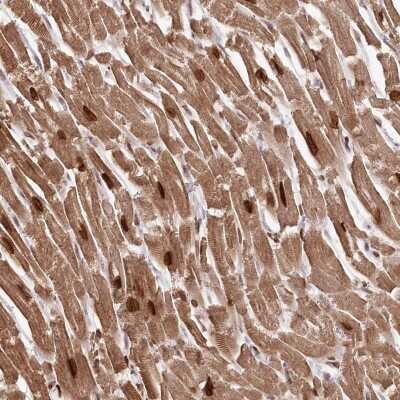 Immunohistochemistry-Paraffin: SORBS2 Antibody [NBP2-32672]