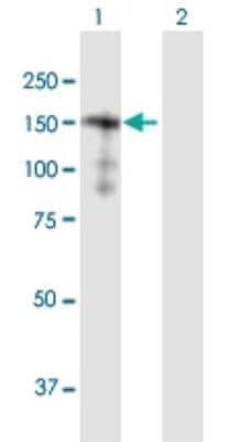 Western Blot: SORBS2 Antibody [H00008470-B01P]