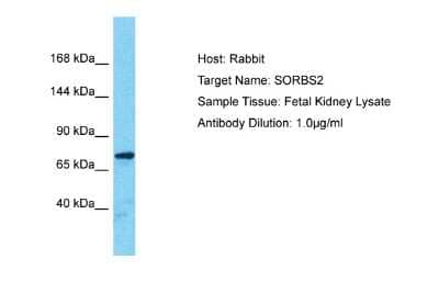 Western Blot: SORBS2 Antibody [NBP2-88335]