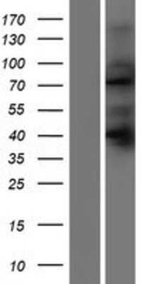 Western Blot: SORBS2 Overexpression Lysate [NBP2-06568]