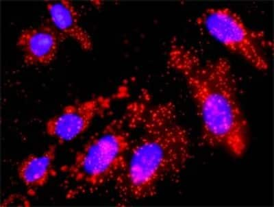 Proximity Ligation Assay: SOS1 Antibody (4C1) [H00006654-M01]