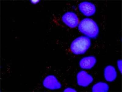 Proximity Ligation Assay: SOS1 Antibody (4C1) [H00006654-M01]