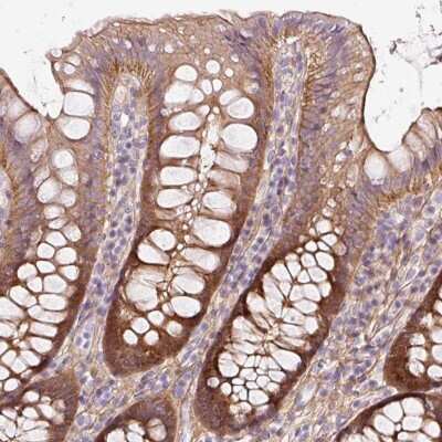 Immunohistochemistry-Paraffin: SOS2 Antibody [NBP2-33487]