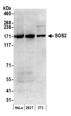 Western Blot: SOS2 Antibody [NBP1-05958]