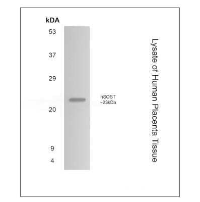 Western Blot: SOST/Sclerostin Antibody (MM0556-9N13)Azide and BSA Free [NBP2-11912]