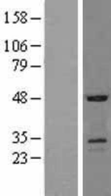 Western Blot: USAG1/SOSTDC1 Overexpression Lysate [NBL1-16342]