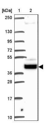 Western Blot: SOWAHD Antibody [NBP2-38081]