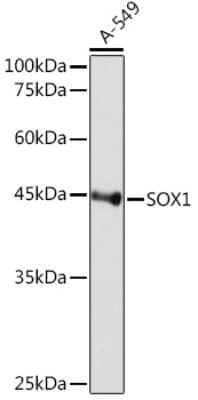 Western Blot: SOX1 Antibody (9L8Z4) [NBP3-16619]