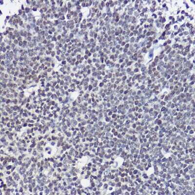 Immunohistochemistry-Paraffin: SOX1 Antibody - Azide and BSA Free [NBP3-16153]