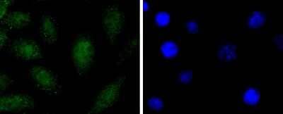 Immunocytochemistry/ Immunofluorescence: SOX1 Antibody (JJ20-40) [NBP2-67864]