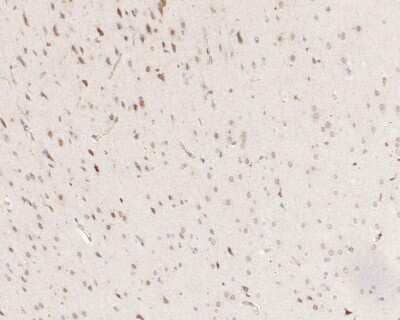 Immunohistochemistry-Paraffin: SOX1 Antibody (JJ20-40) [NBP2-67864]