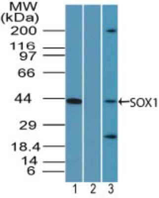 Western Blot: SOX1 Antibody [NBP2-24466]