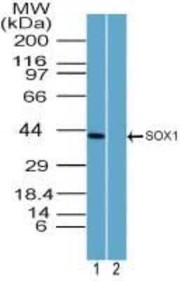 Western Blot: SOX1 Antibody [NBP2-24486]