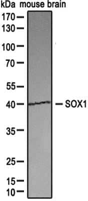 Western Blot: SOX1 Antibody [NBP2-24486]