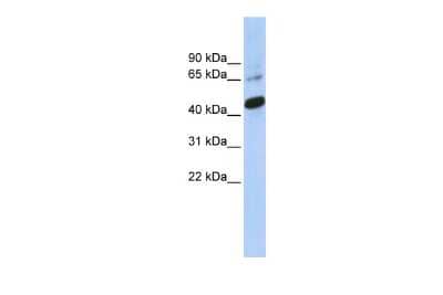 Western Blot: SOX1 Antibody [NBP3-10486]