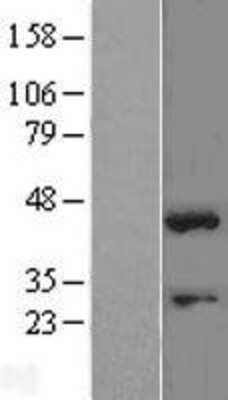 Western Blot: SOX1 Overexpression Lysate [NBL1-16343]