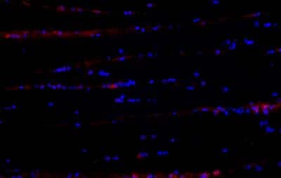 Immunohistochemistry-Frozen: SOX10 Antibody (CL4455) [NBP2-59050]