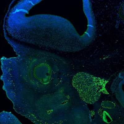 Immunohistochemistry: SOX10 Antibody (CL4455) [NBP2-59050]