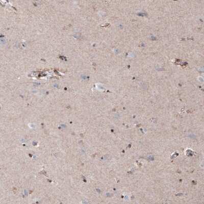 Immunohistochemistry-Paraffin: SOX10 Antibody (CL4455) [NBP2-59050]