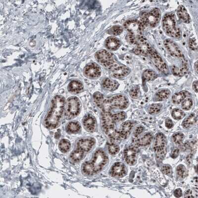 Immunohistochemistry-Paraffin: SOX10 Antibody (CL4455) [NBP2-59050]