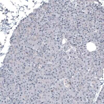 Immunohistochemistry-Paraffin: SOX10 Antibody (CL4455) [NBP2-59050]