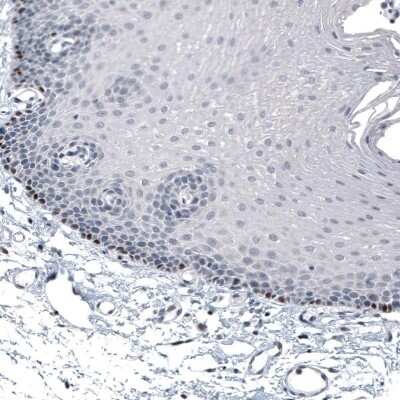 Immunohistochemistry-Paraffin: SOX10 Antibody (CL4455) [NBP2-59050]