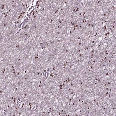 Immunohistochemistry-Paraffin: SOX10 Antibody [NBP2-57023]