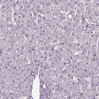 Immunohistochemistry-Paraffin: SOX10 Antibody [NBP2-57023]