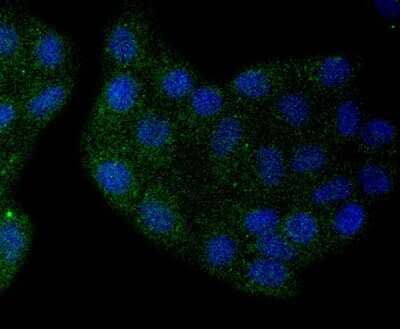 Immunocytochemistry/ Immunofluorescence: SOX10 Antibody (SD204-04) [NBP2-67812]