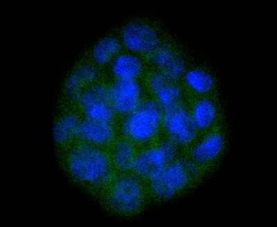 Immunocytochemistry/ Immunofluorescence: SOX10 Antibody (SD204-04) [NBP2-67812]