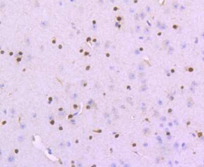 Immunohistochemistry-Paraffin: SOX10 Antibody (SD204-04) [NBP2-67812]