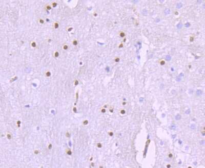 Immunohistochemistry-Paraffin: SOX10 Antibody (SD204-04) [NBP2-67812]