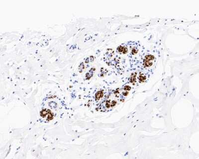 Immunohistochemistry-Paraffin: SOX10 Antibody (SD204-04) [NBP2-67812]