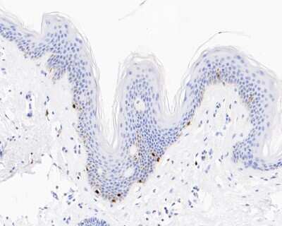Immunohistochemistry-Paraffin: SOX10 Antibody (SD204-04) [NBP2-67812]