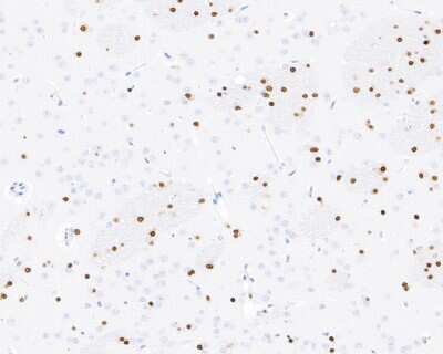 Immunohistochemistry-Paraffin: SOX10 Antibody (SD204-04) [NBP2-67812]