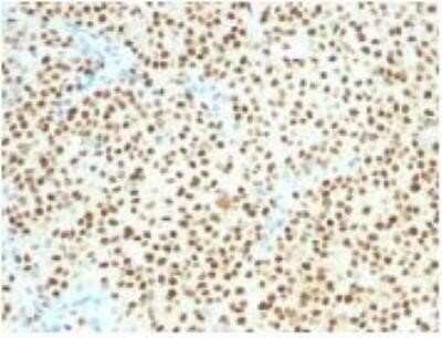 Immunohistochemistry-Paraffin: SOX10 Antibody (SOX10/1074) - Azide and BSA Free [NBP2-59623]