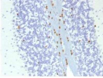 Immunohistochemistry-Paraffin: SOX10 Antibody (SOX10/1074) - Azide and BSA Free [NBP2-59623]