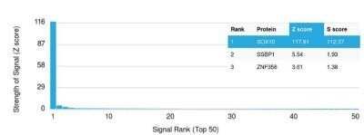 Protein Array: SOX10 Antibody (SOX10/1074) - Azide and BSA Free [NBP2-59623]